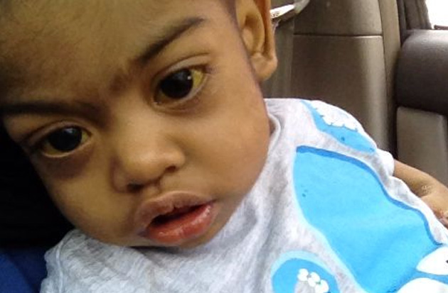 Arshad is set to undergo heart transplant surgery this Oct 30.