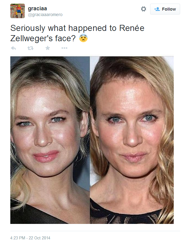 renee zellweger