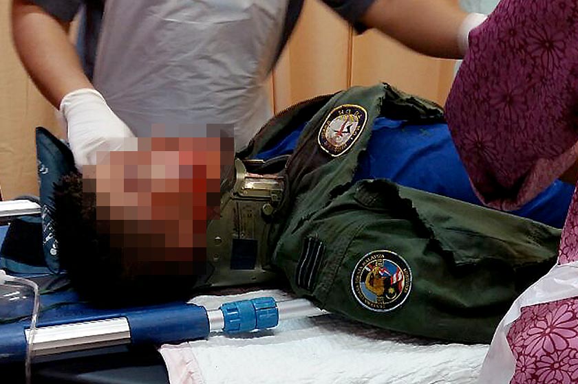 Seorang daripada tiga anak kapal yang cedera sedang menerima rawatan kecemasan di Hospital Seberang Jaya petang ini. - Foto Bernama