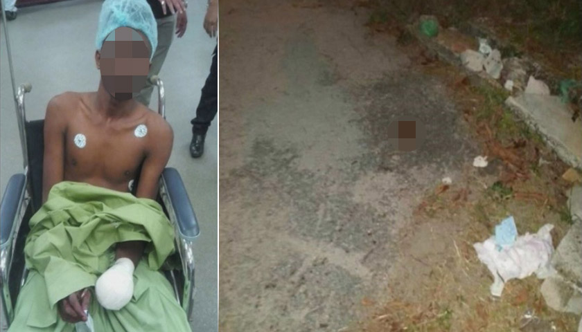 Suspek yang putus pergelangan tangan sedang menerima rawatan.