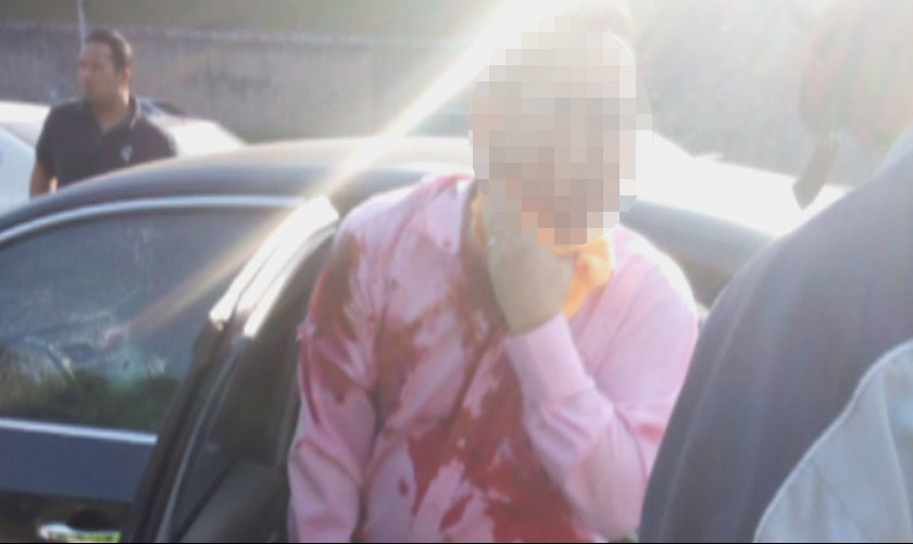 The victim took two shots on the right arm, two on the right side of the neck and one on the chest. - Astro AWANI