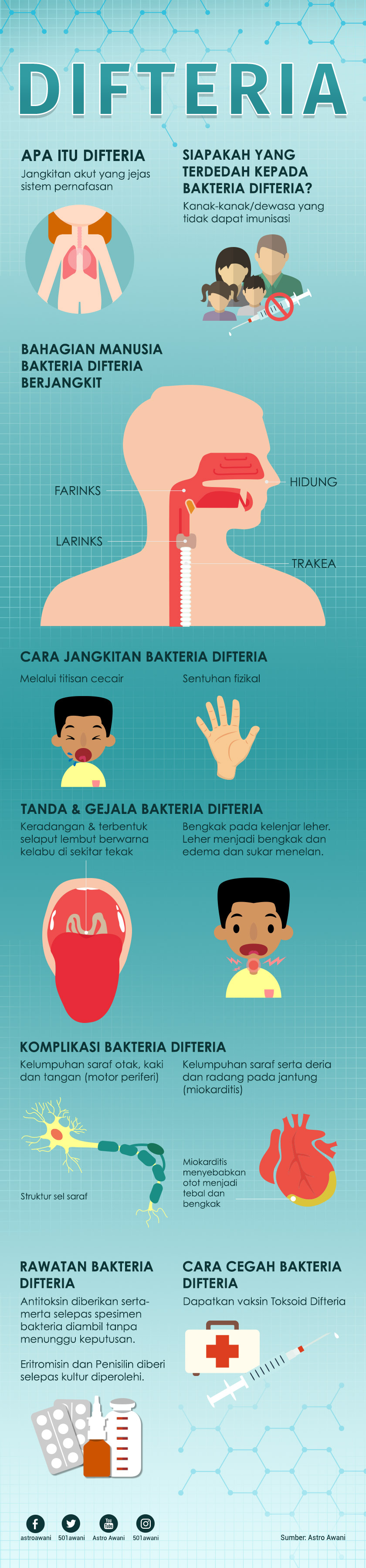 Infografik Difteria