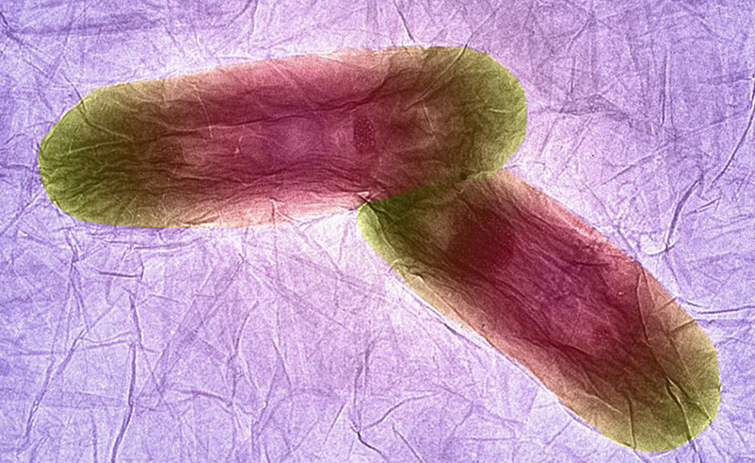 Imej dua bakteria yang berjaya dirakam Izzat dan rakannya. - Gambar Facebook Izzat Fahimuddin