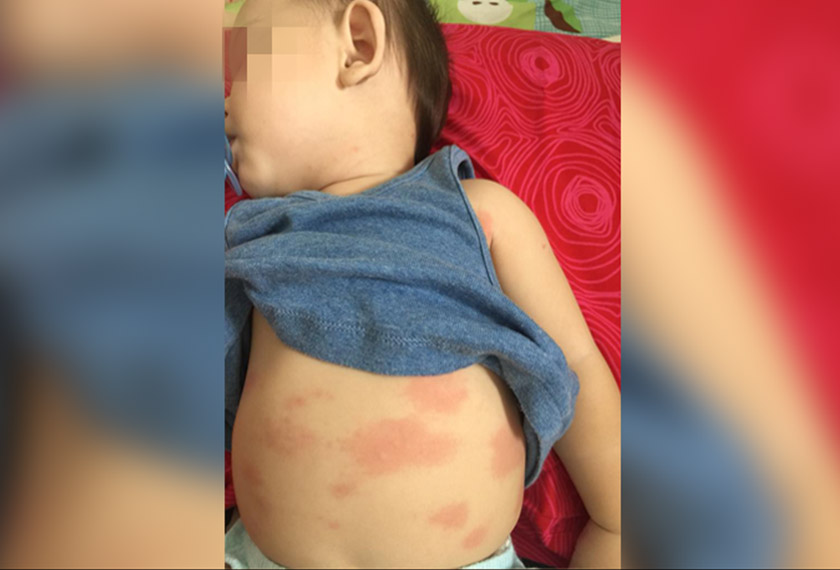 Menurut Norseila, doktor telah menjalankan ujian darah bagi mengesan virus Rota atau Influenza, namun keputusan adalah negatif. - Foto Norseila Nawi