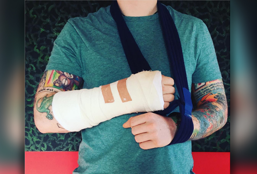 Gambar yang dimuat naik Instagram rasmi Ed Sheeran memaparkan tangannya dibalut dan memakai selempang.