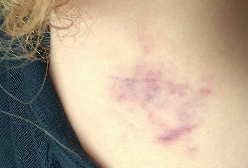 Facebook Keena Mentor II