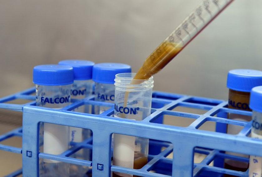 Sampel najis manusia ini diuji di dalam makmal Universiti Ghent, Belgium oleh sepasukan penyelidik. - Reuters