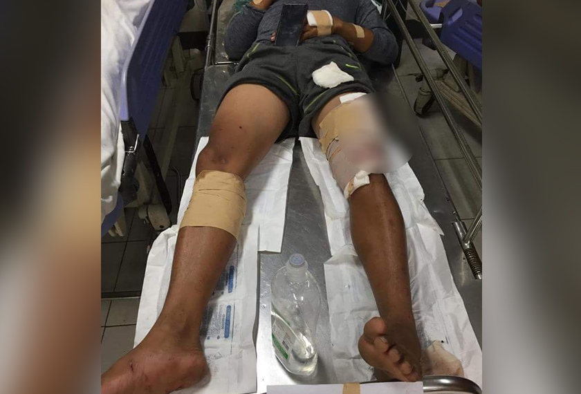 Antara mangsa yang cedera dalam insiden letupan bom tersebut. - Twitter/@philredcross