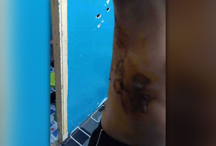 Jabatan Kebajikan Masyarakat (JKM) negeri memaklumkan kanak- kanak itu kini berada dalam pengawasan mereka. - Foto Astro AWANI