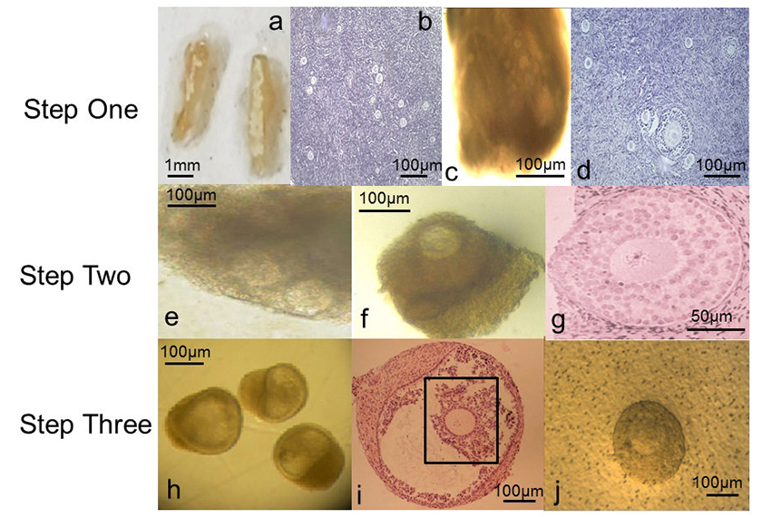 Beberapa imej yang dibesarkan menunjukkan telur manusia dalam beberapa peringkat pertumbuhan - Foto Reuters