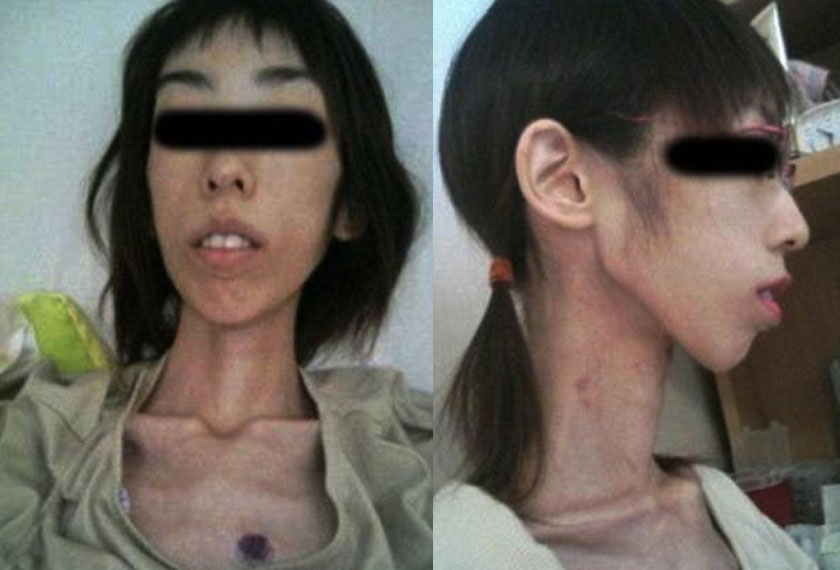 Dia turut mendedahkan gambar yang didakwanya ketika berada di hospital dan menunjukkan tanda-tanda lebam di dada dan leher. -Foto Dailymail.com