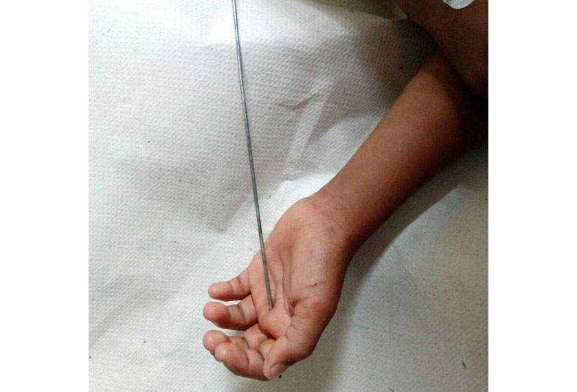 Anggota Bomba ketika memotong batang besi panah tersebut. - Foto ihsan Bomba