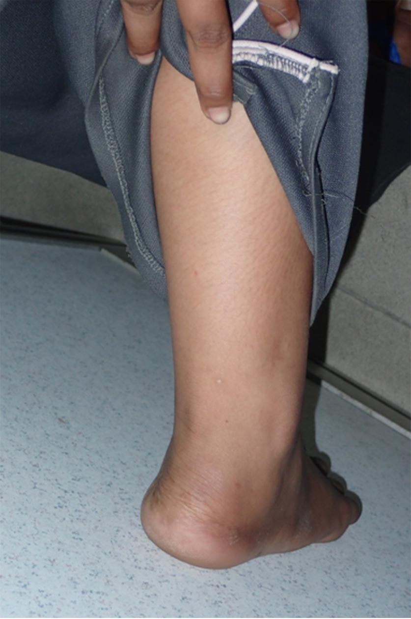 Terdapat kesan lebam pada beberapa bahagian badan mangsa tetapi tiada kecederaan serius. Foto PDRM