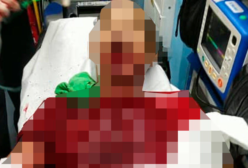 Mangsa meninggal dunia ketika mendapatkan rawatan di Hospital Tengku Ampuan Afzan. 