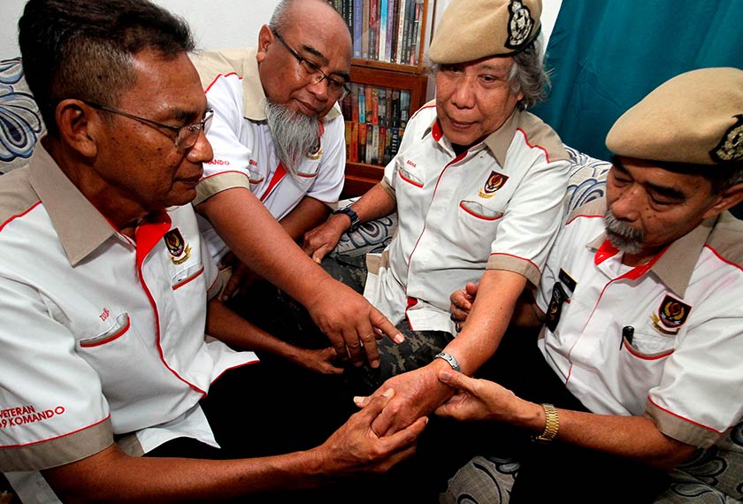 Baharuddin (dua, kanan) menunjukkan kesan tangan kirinya yang patah kepada rakan-rakannya, ketika terlibat Operasi Bamboo II di sempadan Malaysia-Thailand pada 1978, semasa ditemu bual di kediamannya di Tambun. --fotoBERNAMA
