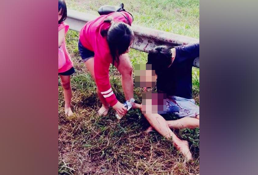 Pemandu kelihatan terduduk menahan sakit akibat terputus tangan kanan. - Sumber foto: media sosial