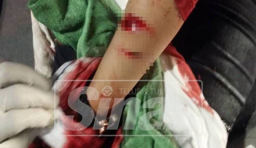 Wanita terbabit mengalami dua luka terhiris pada tangan kirinya akibat dipercayai mengelar diri sendiri. - Foto Sinar Harian