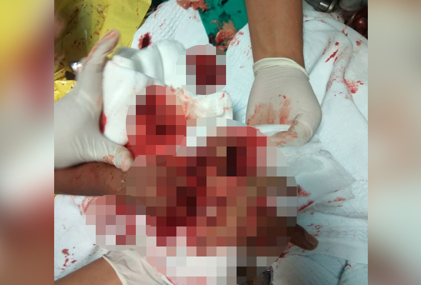 Mangsa kini diserahkan kepada pihak hospital untuk mendapatkan rawatan lanjut. - Foto JBPM