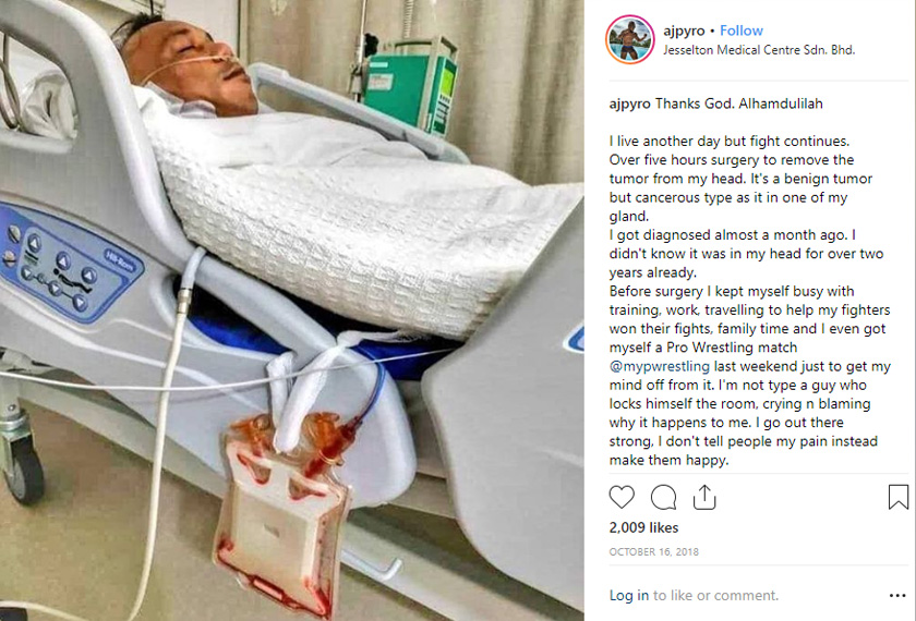 AJ menjalani rawatan selama lima hari di hospital. - Foto Instagram/@ajpyro