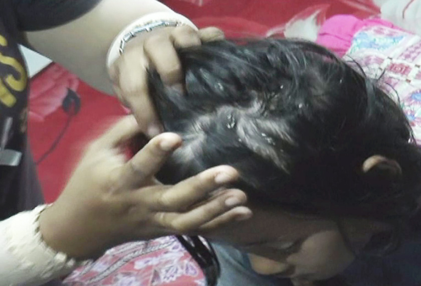 Nur Qalisya terpaksa menanggung derita akibat seluruh kulit badannya menggelupas, gatal-gatal dan pedih.