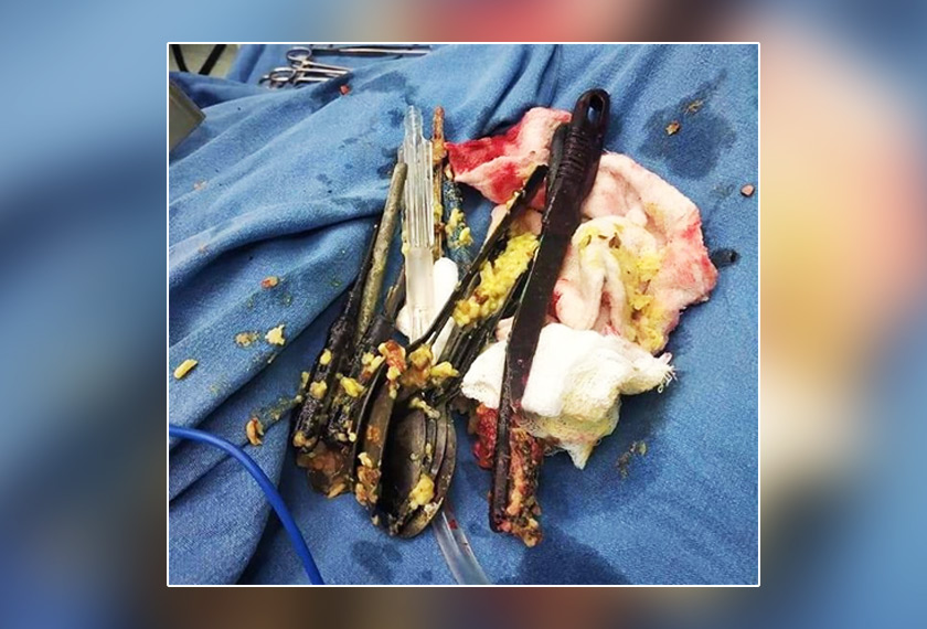 Hasil pembedahan mendapati terdapat lapan sudu, dua berus gigi, dua pemutra skru kecil, satu pisau dan satu batang besi kecil dalam perut pesakit itu. Foto: Times of India