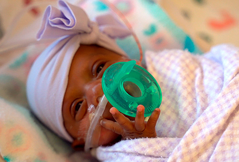 Pada awalnya doktor menjangkakan Saybie hanya mampu bertahan sejam saja di dunia, namun takdir menentukan dia panjang umur. - Gambar AP