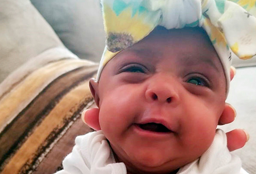 Sekalipun dilahirkan dengan saiz sebesar buah epal, namun sifat Saybie sempurna seperti bayi lain. - Gambar AP 