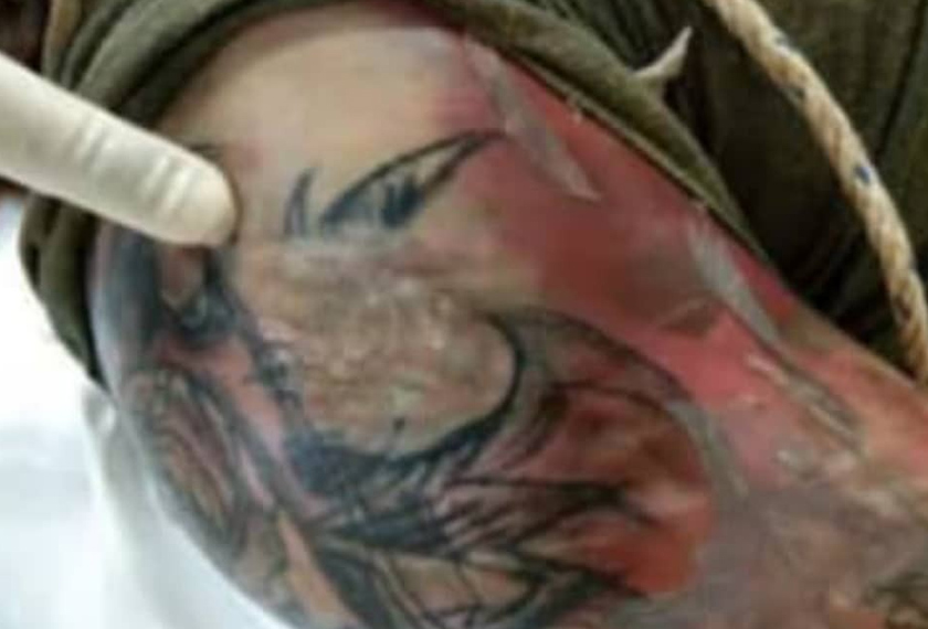 Mangsa mempunyai tatu berbentuk bunga di sebelah kanan atas bahu. - Foto ihsan polis