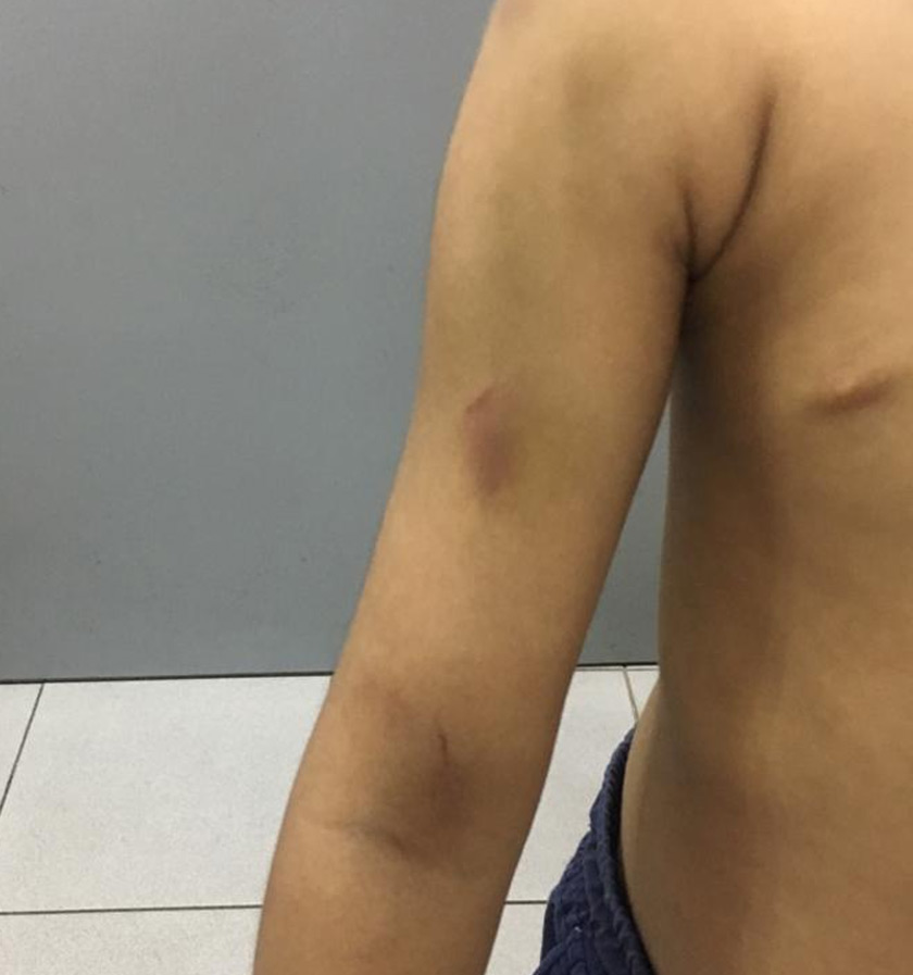 Mangsa telah dimasukkan ke wad Hospital Pulau Pinang  ( HPP) untuk pemeriksaan lanjut dan kini dipantau pihak Jabatan Kebajikan Masyarakat (JKM). - Foto Astro AWANI