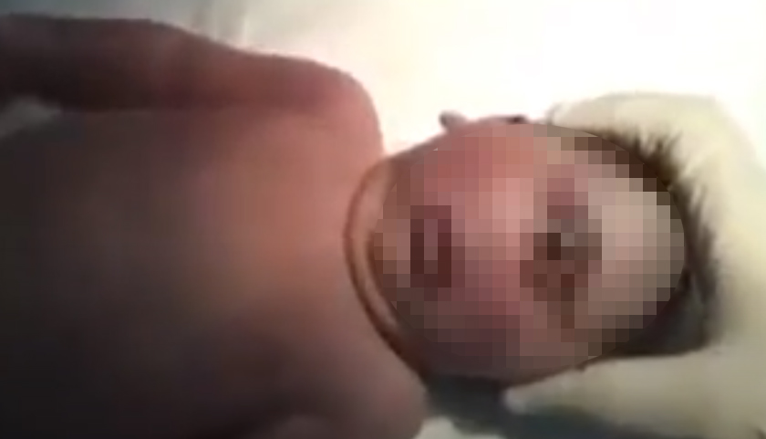 Sebenarnya itu bukanlah dajal tetapi satu fenomena yang jarang berlaku melibatkan bayi baru lahir digelar ‘cyclopia’.