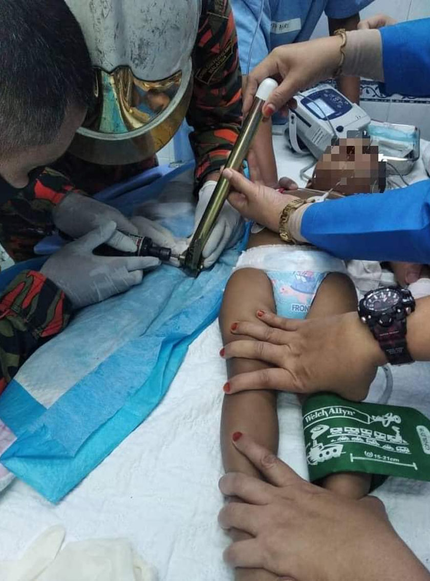 Kanak-kanak terbabit terpaksa menahan kesakitan selepas ibu jarinya tersepit pada kaki meja di rumahnya hari ini. - Foto JBPM