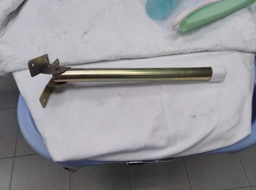  Bomba berjaya mengeluarkan ibu jari kanak kanak itu dalam masa 15 minit. - Foto JBPM