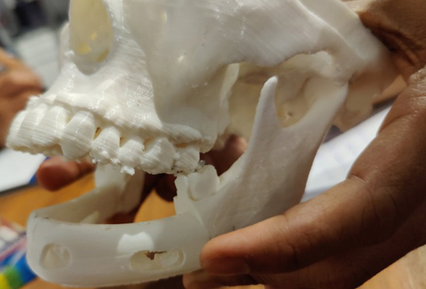 Model cetakan implan 3D titanium yang digunakan kepada pesakit yang mengalami masalah pembengkakan rahang. - Gambar Avisena Specialist Hospital