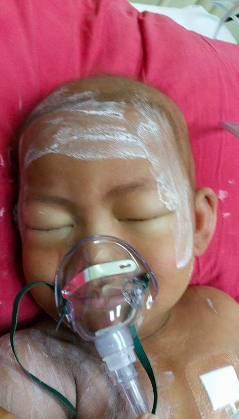 Anak kedua Mazliana Ahmad menerima rawatan kemoterapi di HKL. -Foto: Mazliana Ahmad