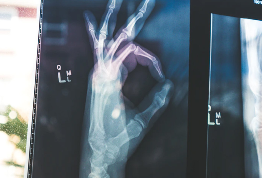 Cutting back on the bottleneck of waiting times for diagnostic procedures such as MRI scans, CT scans, treadmill tests, echocardiograms, angiograms, etc. and ensuring no shortage beds available are some of the key concerns when it comes to public hospitals. Image via unsplash