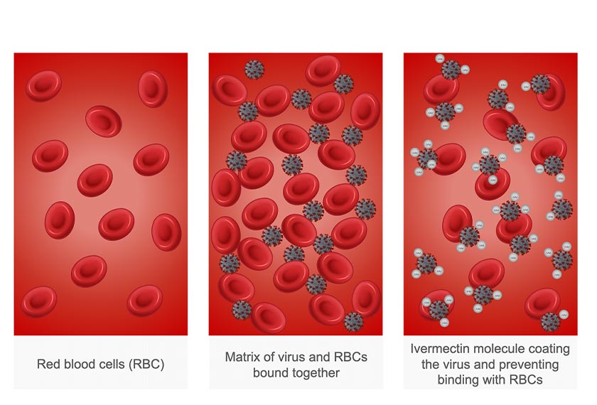 Source: Adapted from David E. Scheim