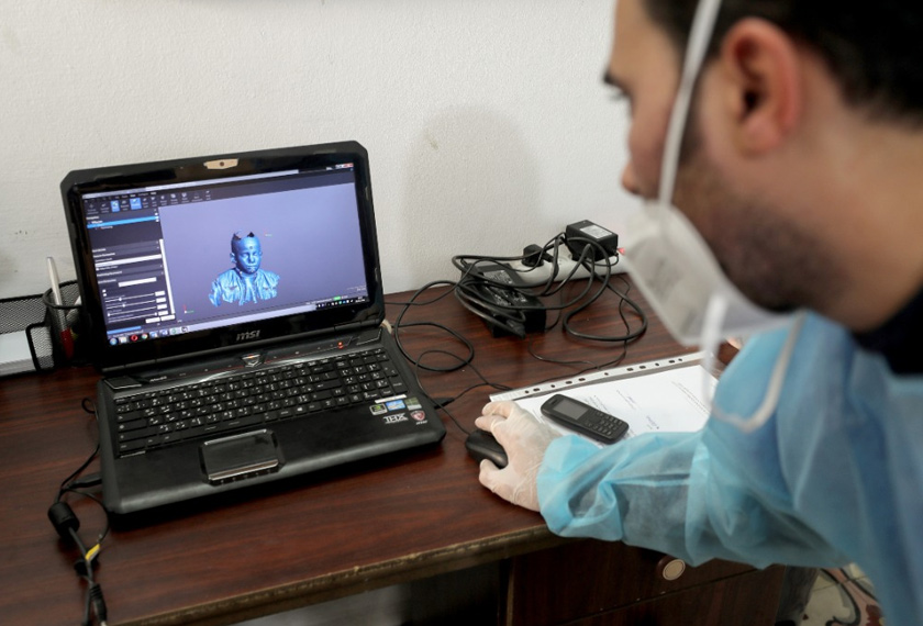 A physiotherapist works on a laptop as he designs 3D transparent face mask for Palestinian boy Ahmed Al-Deeb, who has severe facial burns, at Medecins Sans Frontieres (MSF)'s clinic in Gaza City. REUTERSpic