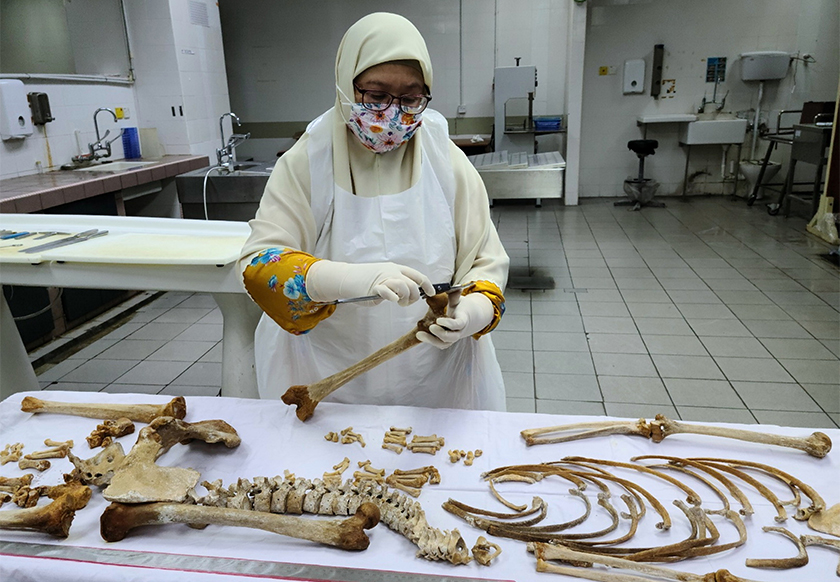 Dr Faridah melakukan pemeriksaan ke atas rangka manusia bagi tujuan siasatan. --fotoBERNAMA