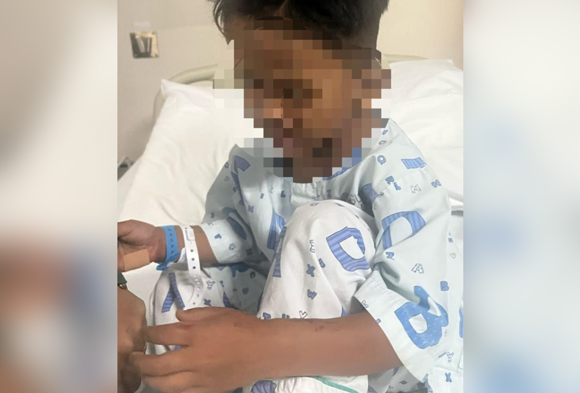 Mangsa mercun bola kini dirawat di Hospital Sultanah Bahiyah, Alor Setar.