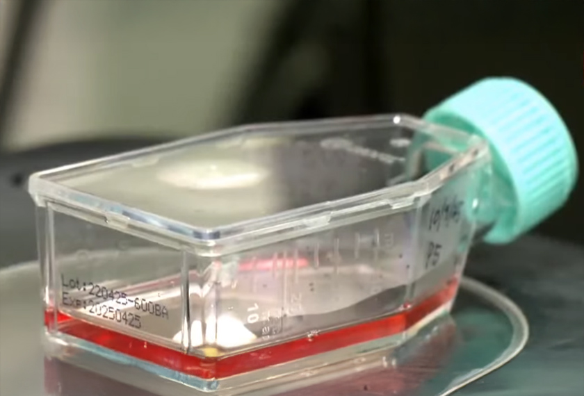 Pesakit sakit belakang kini ada harapan baharu dengan inovasi Hidrogel dan Sel Stem dari UKM