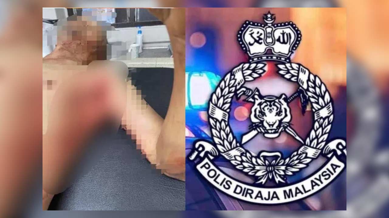 Satu lagi kes cedera ditanduk haiwan korban di Johor