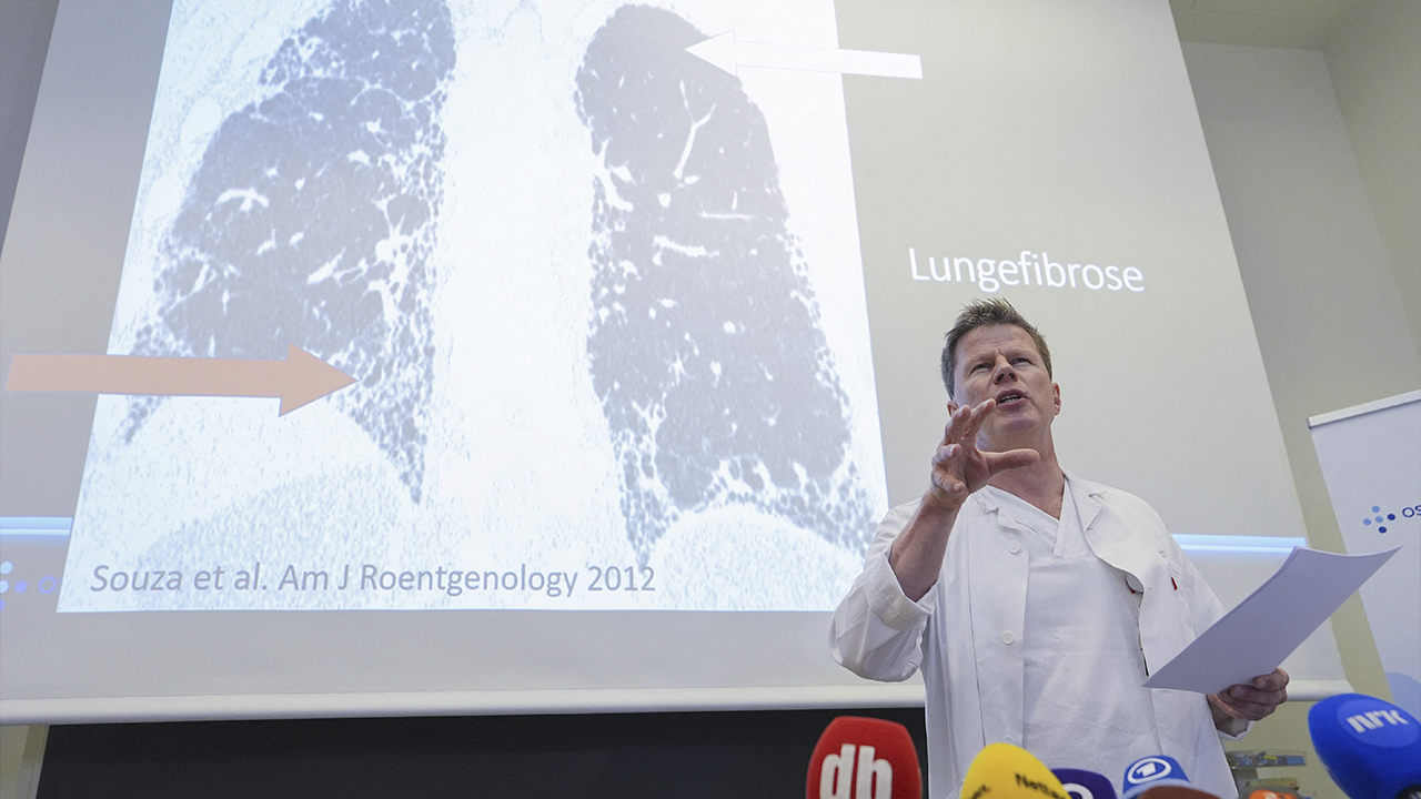 Puteri Mahkota Norway tersenarai untuk pemindahan paru-paru